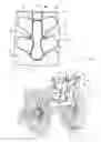 Fig. 04 - Supportive back overlay for wheelchair back