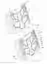 Fig. 06 - Supportive back overlay for wheelchair back
