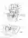 Fig. 02 - Child restraint for vehicle