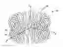 Fig. 01 - Inductor assembly for a magnetic resonance imaging system