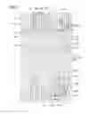 Fig. 02 - Liquid crystal display
