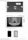 Fig. 14 - LIQUID CRYSTAL PANEL, METHOD FOR MANUFACTURING SAME, AND LIQUID CRYSTAL DISPLAY DEVICE