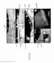 Fig. 17 - Systems, methods and computer-accessible medium which provide microscopic images of at least one anatomical structure at a particular resolution