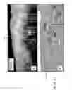 Fig. 20 - Systems, methods and computer-accessible medium which provide microscopic images of at least one anatomical structure at a particular resolution