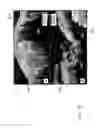 Fig. 22 - Systems, methods and computer-accessible medium which provide microscopic images of at least one anatomical structure at a particular resolution