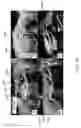 Fig. 25 - Systems, methods and computer-accessible medium which provide microscopic images of at least one anatomical structure at a particular resolution