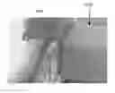 Fig. 01 - Extended cavity VCSEL mounted to substrate with electrical and thermal contact to substrate and optical power directed toward substrate