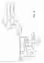 Fig. 14 - Detection of word-line leakage in memory arrays