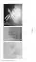 Fig. 03 - Miniaturized electronic device ingestible by a subject or implantable inside a body of the subject