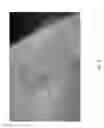 Fig. 19 - Miniaturized electronic device ingestible by a subject or implantable inside a body of the subject