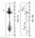 Fig. 04 - Voice detection for automatic volume controls and voice sensors