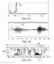 Fig. 05 - Voice detection for automatic volume controls and voice sensors