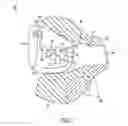 Fig. 02 - Hearing aid with occlusion reduction
