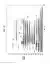 Fig. 07 - Pitch perception in an auditory prosthesis