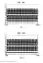 Fig. 14 - Pitch perception in an auditory prosthesis