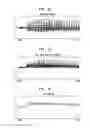 Fig. 16 - Pitch perception in an auditory prosthesis