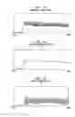 Fig. 18 - Pitch perception in an auditory prosthesis
