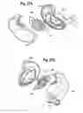 Fig. 22 - Earphone assembly