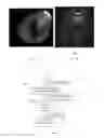 Fig. 03 - Method and apparatus for 3D metal and high-density artifact correction for cone-beam and fan-beam CT imaging