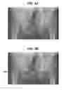Fig. 04 - Method and device for digital image templating