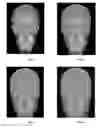 Fig. 06 - Method for correction of digital images