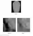 Fig. 07 - Method for correction of digital images