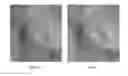 Fig. 08 - Method for correction of digital images