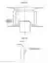 Fig. 09 - MULTIBLADE FAN