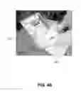 Fig. 04 - Method for radiation sterilization of medical devices using a package having modifier sections