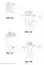 Fig. 06 - Method for radiation sterilization of medical devices using a package having modifier sections