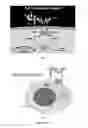Fig. 16 - Bioartificial liver