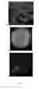 Fig. 19 - Bioartificial liver