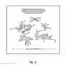 Fig. 07 - Systems for increasing catalyst concentration in heavy oil and/or coal resid hydrocracker
