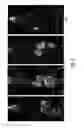 Fig. 07 - PSMA-targeting compounds and uses thereof