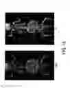 Fig. 15 - PSMA-targeting compounds and uses thereof