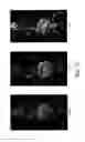 Fig. 16 - PSMA-targeting compounds and uses thereof