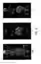 Fig. 17 - PSMA-targeting compounds and uses thereof