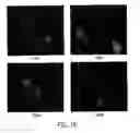 Fig. 20 - PSMA-targeting compounds and uses thereof