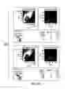 Fig. 28 - PSMA-targeting compounds and uses thereof