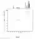 Fig. 93 - Gastrin releasing peptide compounds