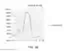 Fig. 03 - METHODS OF PREDICTING RESPONSIVENESS TO INTERFERON TREATMENT AND TREATING HEPATITIS C INFECTION