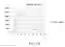 Fig. 05 - METHODS OF PREDICTING RESPONSIVENESS TO INTERFERON TREATMENT AND TREATING HEPATITIS C INFECTION