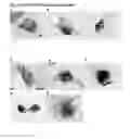 Fig. 09 - COMPOSITIONS FOR BACTERIAL MEDIATED GENE SILENCING AND METHODS OF USING THE SAME