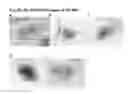 Fig. 10 - COMPOSITIONS FOR BACTERIAL MEDIATED GENE SILENCING AND METHODS OF USING THE SAME