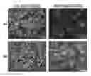 Fig. 01 - VENTRICULAR INDUCED PLURIPOTENT STEM (ViPS) CELLS FOR GENERATION OF AUTOLOGOUS VENTRICULAR CARDIOMYOCYTES AND USES THEREOF