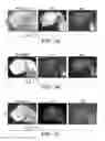 Fig. 05 - VENTRICULAR INDUCED PLURIPOTENT STEM (ViPS) CELLS FOR GENERATION OF AUTOLOGOUS VENTRICULAR CARDIOMYOCYTES AND USES THEREOF