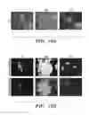 Fig. 18 - VENTRICULAR INDUCED PLURIPOTENT STEM (ViPS) CELLS FOR GENERATION OF AUTOLOGOUS VENTRICULAR CARDIOMYOCYTES AND USES THEREOF