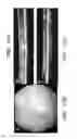 Fig. 10 - Biocompatible substrate for facilitating interconnections between stem cells and target tissues and methods for implanting same