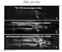 Fig. 30 - Biocompatible substrate for facilitating interconnections between stem cells and target tissues and methods for implanting same