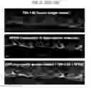 Fig. 31 - Biocompatible substrate for facilitating interconnections between stem cells and target tissues and methods for implanting same